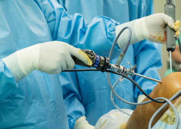Arthroscopic Stabilization | Manhattan NY