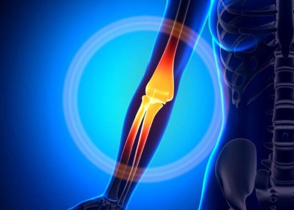 Elbow Epicondylitis | Manhattan NY