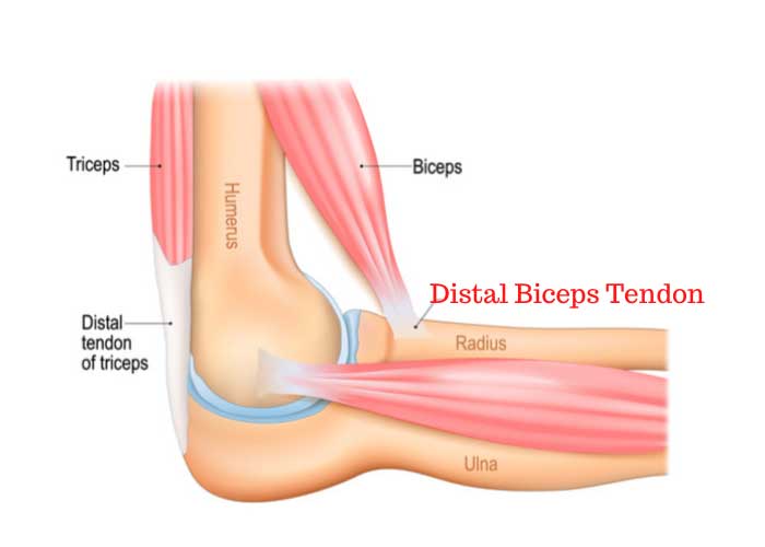 Distal Biceps Tendon | Manhattan NY